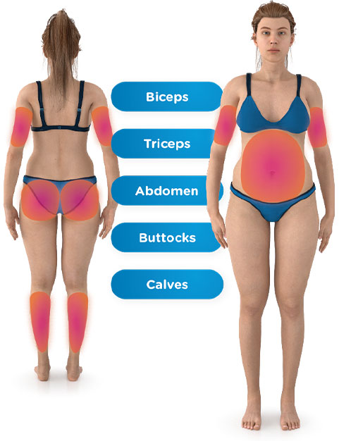 Diagram of areas EMSCULPT NEO® treatment can be performed on