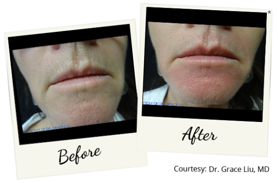 exilis-ba-9
