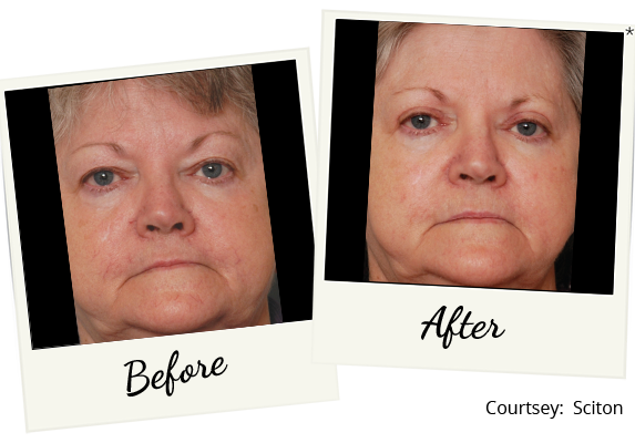 clear-v_b&a_04