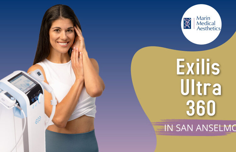 Body Sculpting Exilis Ultra 360 in San Anselmo