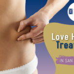 Love Handles Treatment in San Anselmo