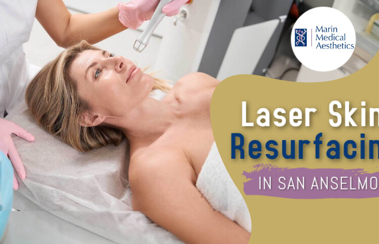 Laser Skin Resurfacing in San Anselmo