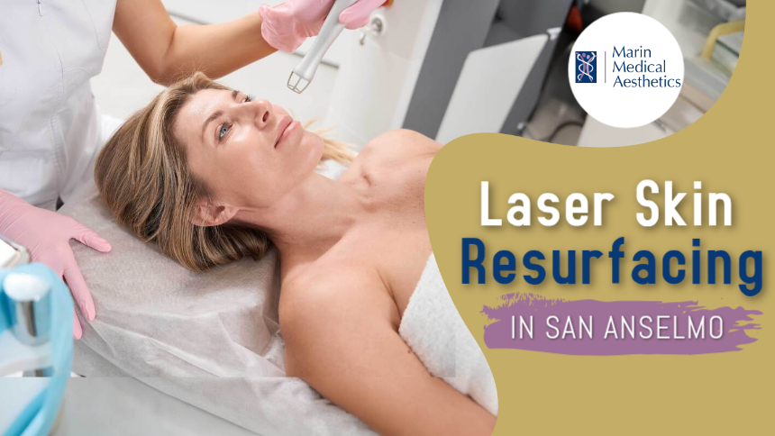 Laser Skin Resurfacing in San Anselmo