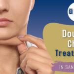 Double Chin Treatment in San Anselmo