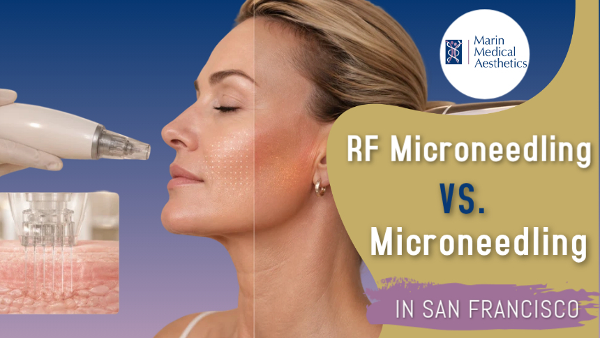 RF Microneedling vs. Microneedling in San Francisco