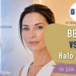 BBL vs. Halo Laser in San Francisco