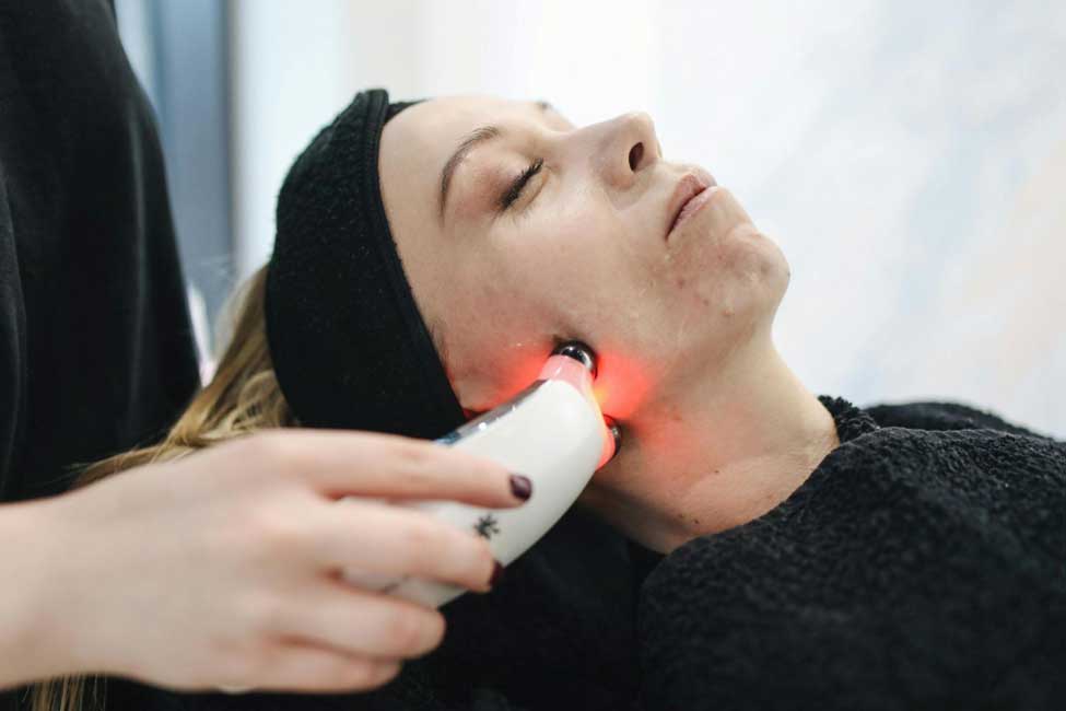 Best Acne Scar Treatments Bay Area