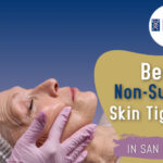 Best Non-Surgical Skin Tightening in San Francisco