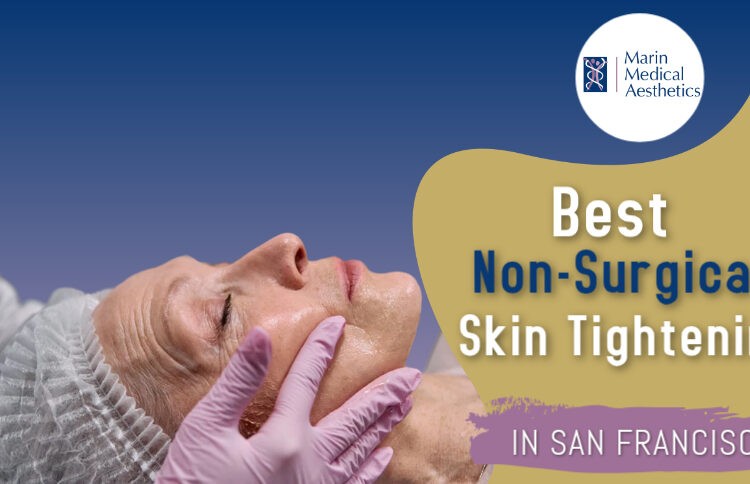 Best Non-Surgical Skin Tightening in San Francisco