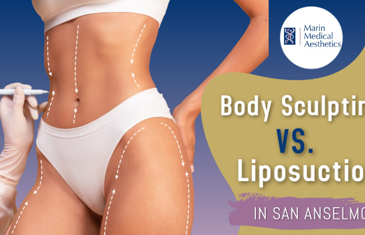 Body Sculpting vs. Liposuction in San Anselmo