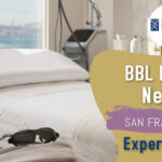 BBL Laser Near San Francisco: Expert Guide