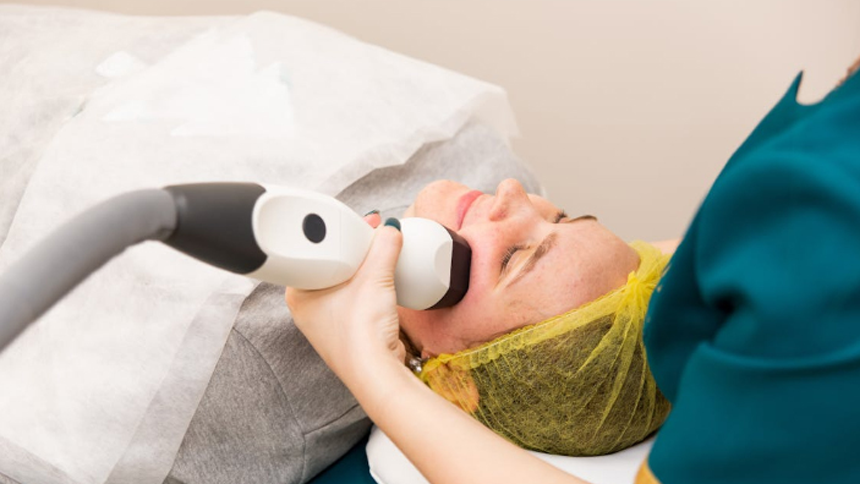 Laser resurfacing treatment at Marin Medical Aesthetics to improve facial redness, skin texture, and tone