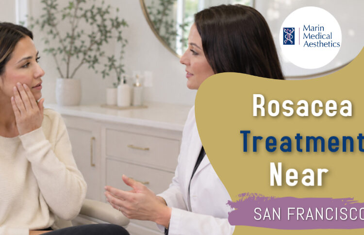 Rosacea treatment at Marin Medical Aesthetics to help reduce facial redness and improve skin appearance