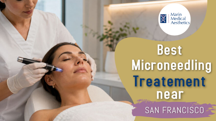 Microneedling treatment at Marin Medical Aesthetics to improve skin texture and achieve a smoother appearance