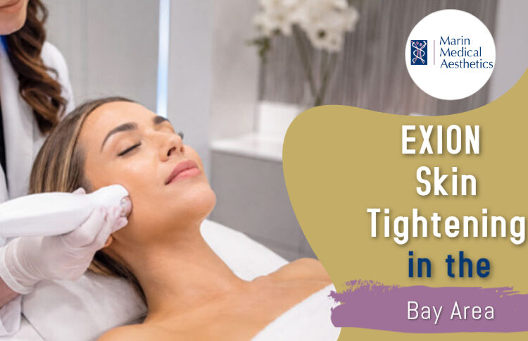 EXION Skin Tightening treatment for firmer, rejuvenated skin at Marin Medical Aesthetics