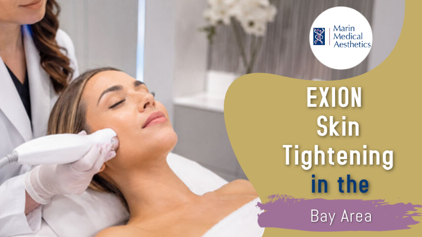 EXION Skin Tightening treatment for firmer, rejuvenated skin at Marin Medical Aesthetics