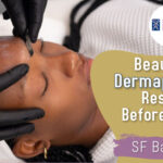 Dermaplaning in Bay Area