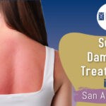 Sun Damage Treatment in San Anselmo