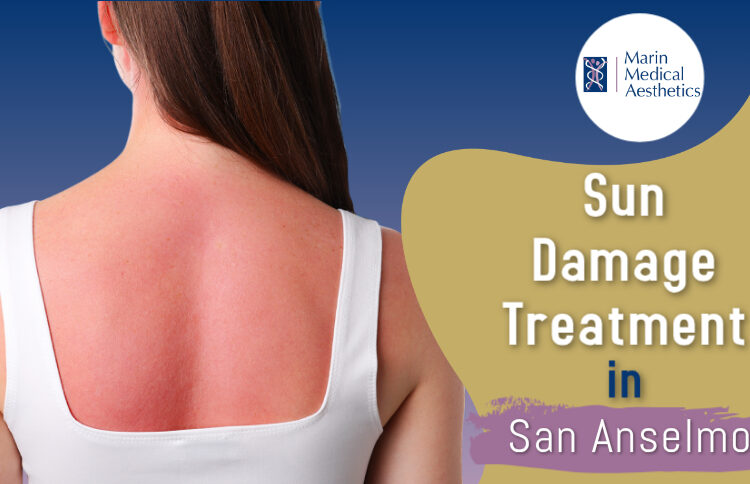 Sun Damage Treatment in San Anselmo