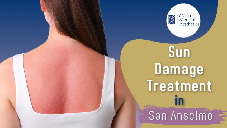 468 -blog image (14) Sun Damage Treatment in San Anselmo